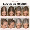 AUVRENE® Root Revival Scalp Serum for Fine Hair